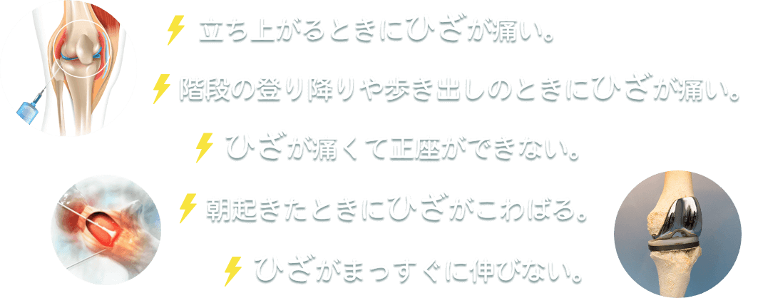 立ち上がるときに痛い。痛くて正座ができない。朝起きたときに膝がこわばる。階段の上り下りや歩き出しのときに痛い。膝がまっすぐに伸びない。